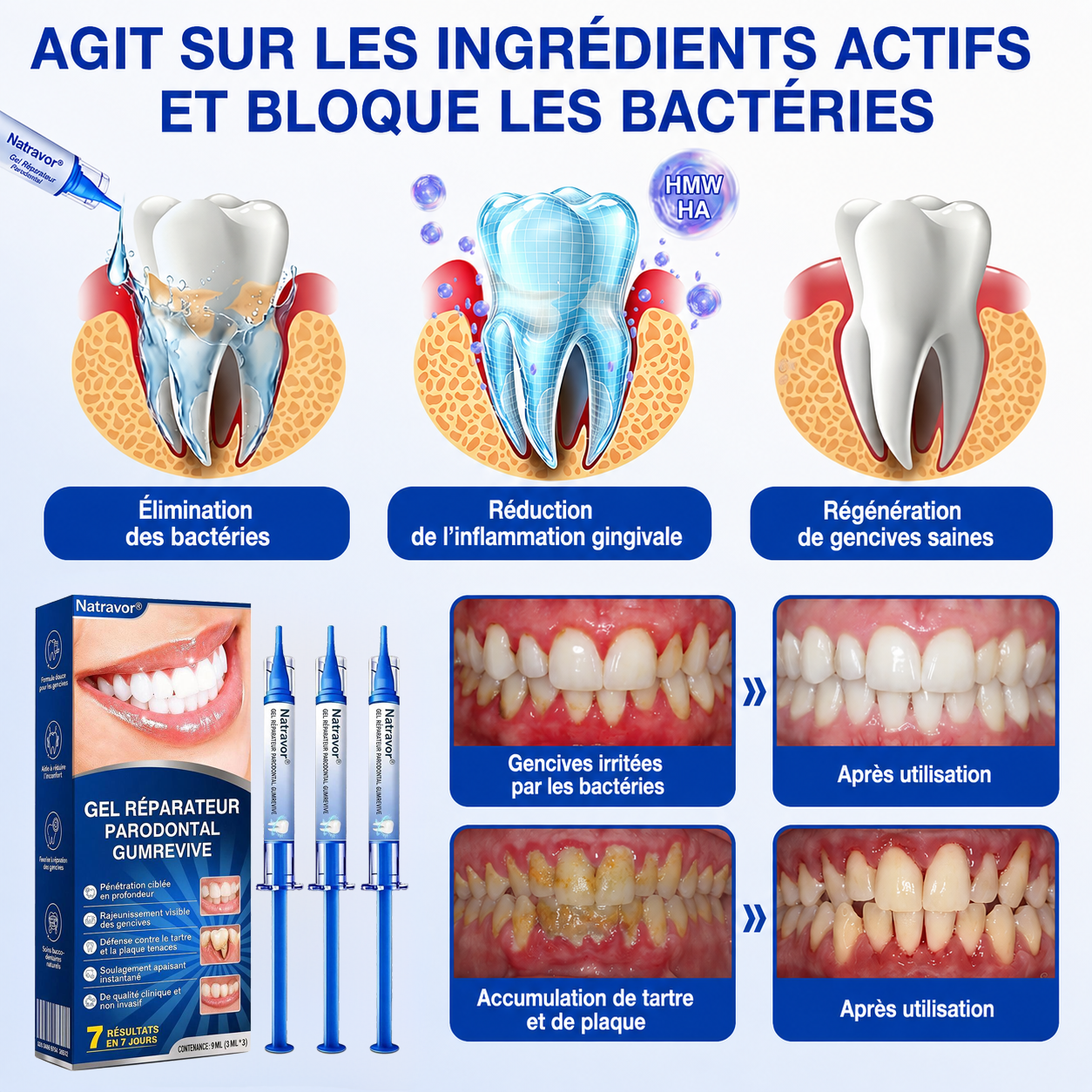 🦷𝐍𝐚𝐭𝐫𝐚𝐯𝐨𝐫® GumRevive Gel de soin des gencives et du parodonte