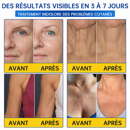 🌊🔥𝐍𝐚𝐭𝐫𝐚𝐯𝐨𝐫® PDRN Soin Anti-Rides – Crème Liftante et Raffermissante