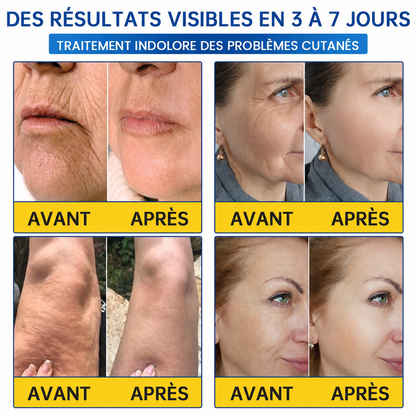 🌊🔥𝐍𝐚𝐭𝐫𝐚𝐯𝐨𝐫® PDRN Soin Anti-Rides – Crème Liftante et Raffermissante