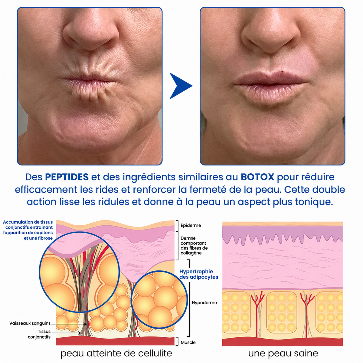 🌊🔥𝐍𝐚𝐭𝐫𝐚𝐯𝐨𝐫® PDRN Soin Anti-Rides – Crème Liftante et Raffermissante
