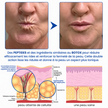 🌊🔥𝐍𝐚𝐭𝐫𝐚𝐯𝐨𝐫® PDRN Soin Anti-Rides – Crème Liftante et Raffermissante