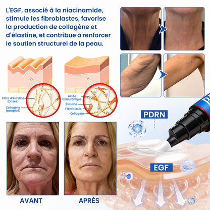🌊🔥𝐍𝐚𝐭𝐫𝐚𝐯𝐨𝐫® PDRN Soin Anti-Rides – Crème Liftante et Raffermissante