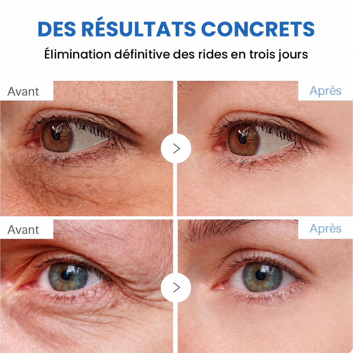 🌊🔥𝐍𝐚𝐭𝐫𝐚𝐯𝐨𝐫® PDRN Soin Anti-Rides – Crème Liftante et Raffermissante