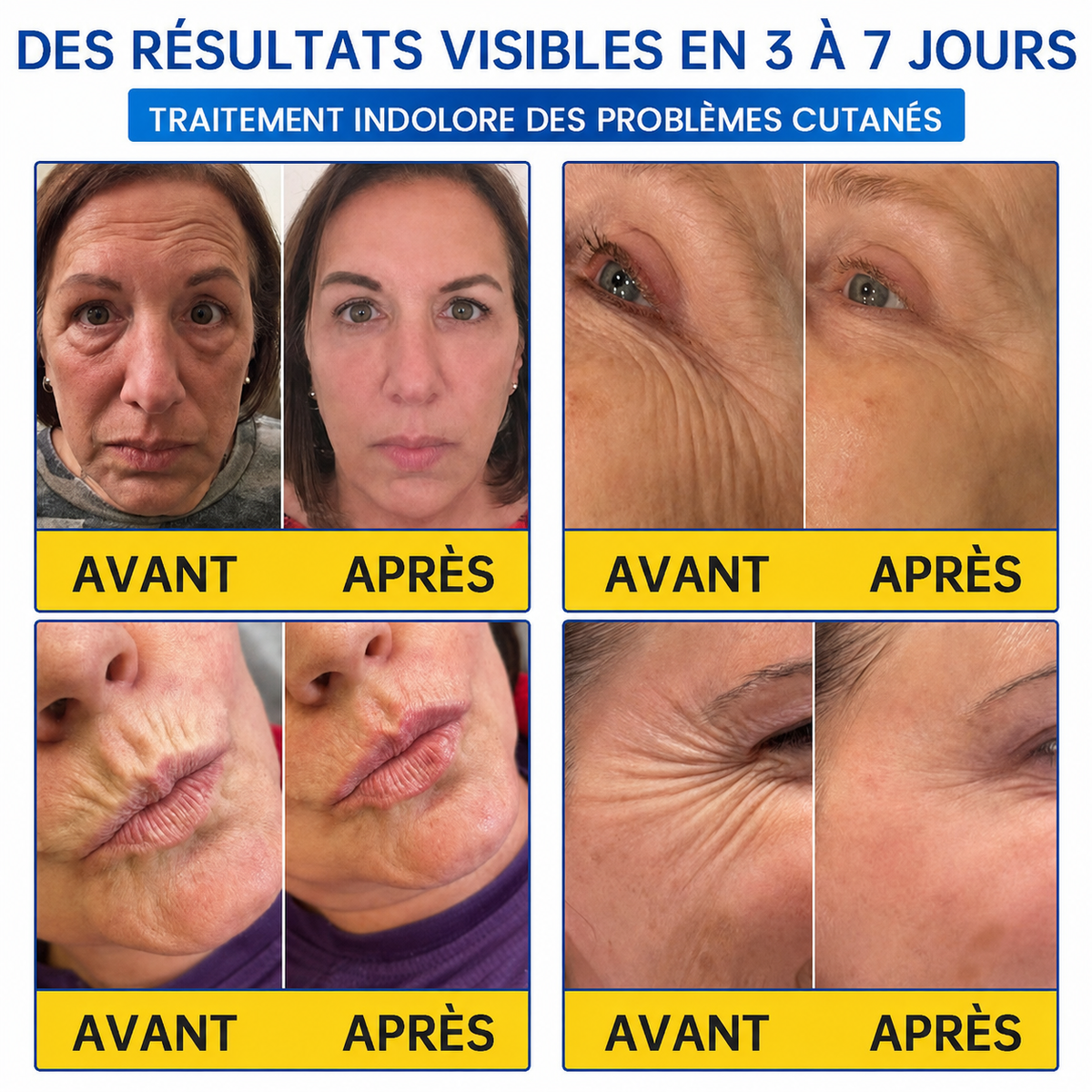 🌊🔥𝐍𝐚𝐭𝐫𝐚𝐯𝐨𝐫® PDRN Soin Anti-Rides – Crème Liftante et Raffermissante