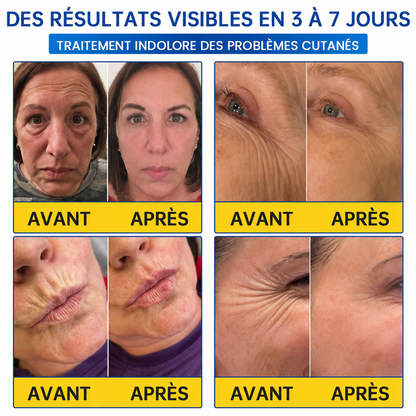 🌊🔥𝐍𝐚𝐭𝐫𝐚𝐯𝐨𝐫® PDRN Soin Anti-Rides – Crème Liftante et Raffermissante