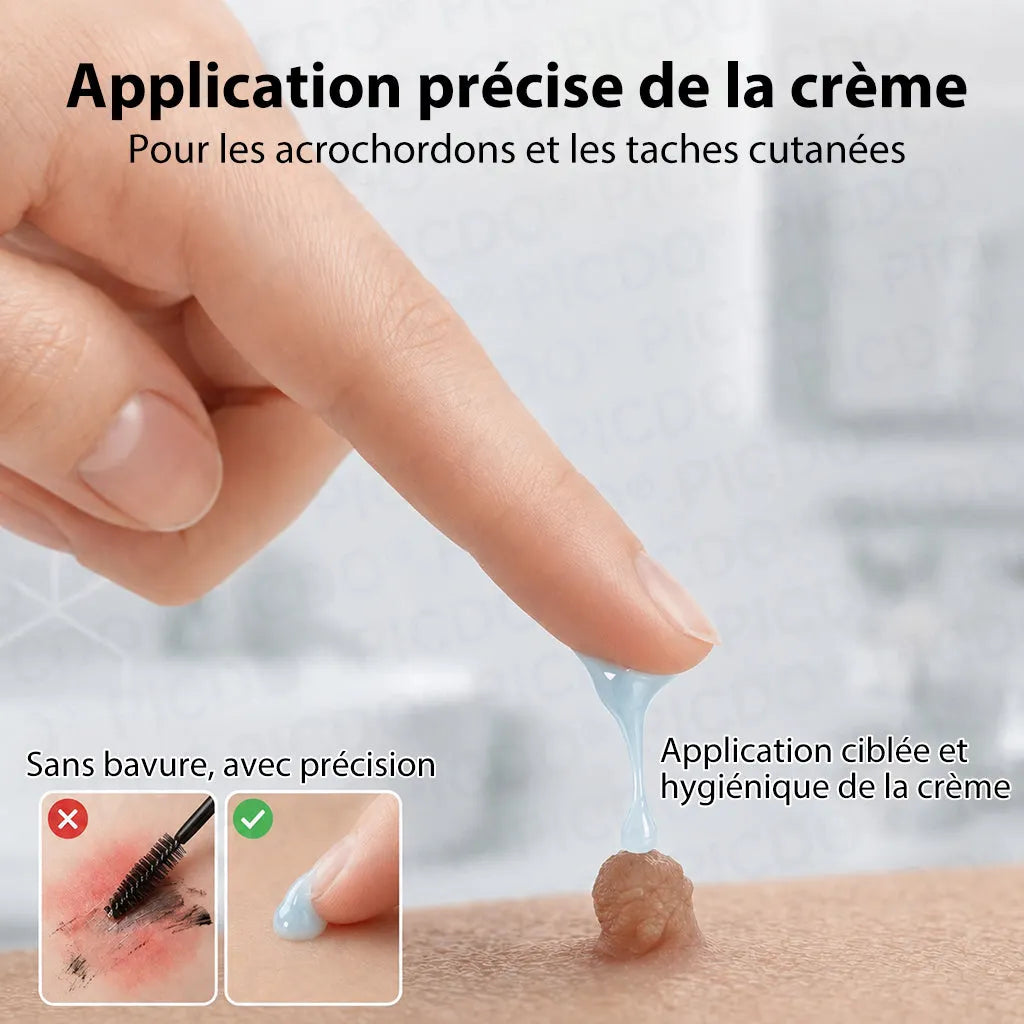 Natravor® 🪴 Crème Éliminatrice de Verrues et Taches Cutanées – 7 Jours (Formule Zéro Douleur, Zéro Cicatrice) 🪴