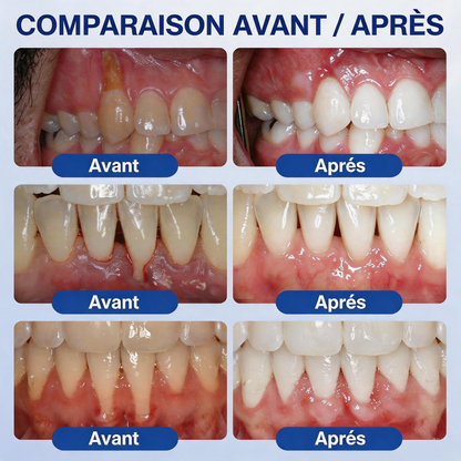 🦷𝐍𝐚𝐭𝐫𝐚𝐯𝐨𝐫® GumRevive Gel de soin des gencives et du parodonte