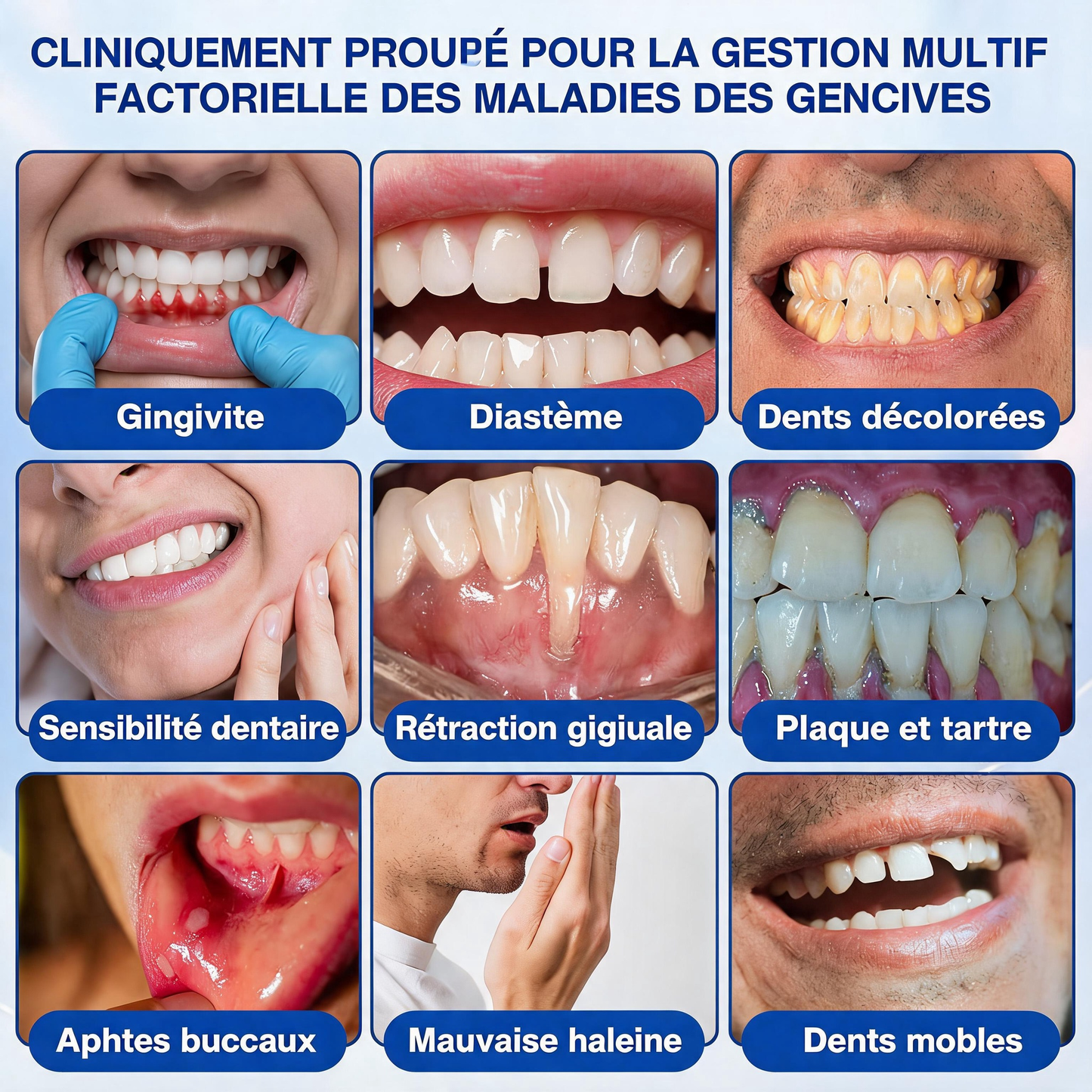 🦷𝐍𝐚𝐭𝐫𝐚𝐯𝐨𝐫® GumRevive Gel de soin des gencives et du parodonte