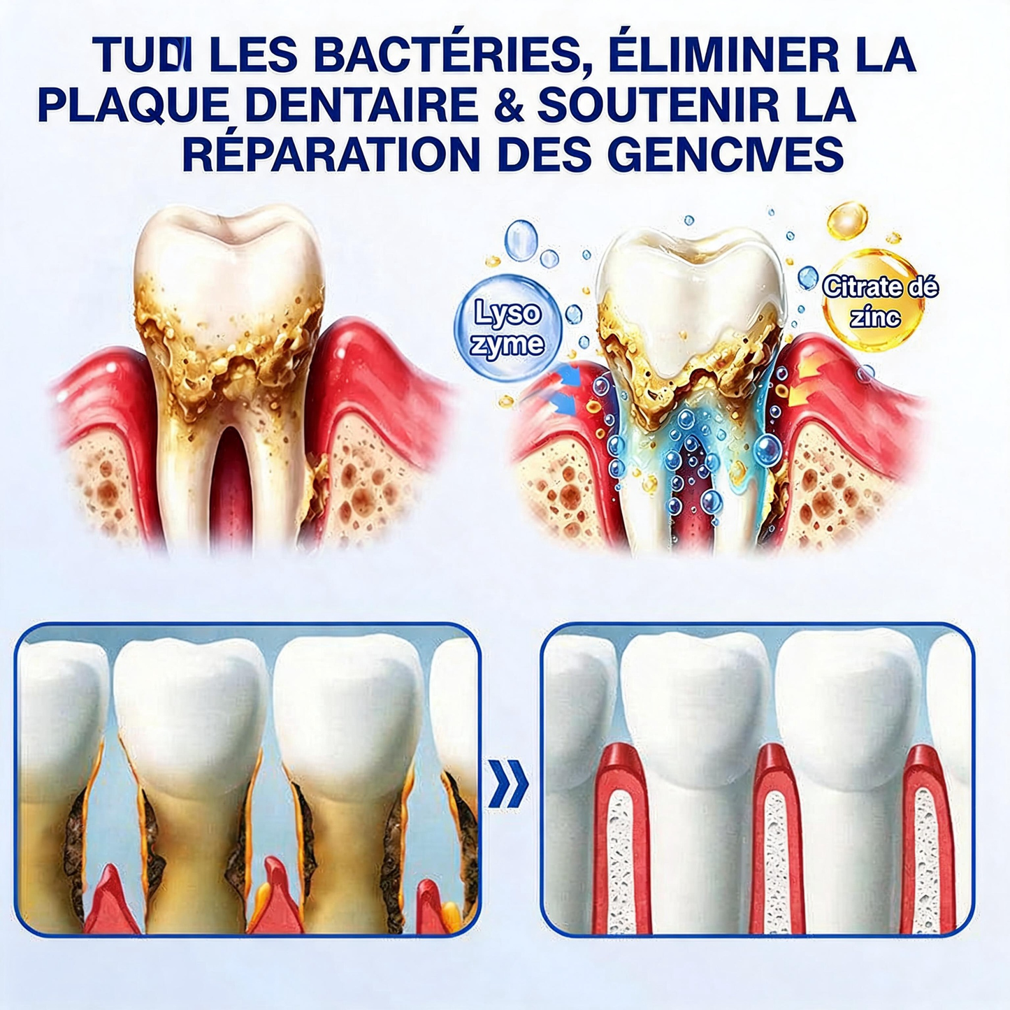 🦷𝐍𝐚𝐭𝐫𝐚𝐯𝐨𝐫® GumRevive Gel de soin des gencives et du parodonte